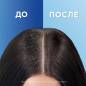 Шампунь HEAD&SHOULDERS Для чувствительной кожи головы 400 мл (5000174391695) - Фото 6