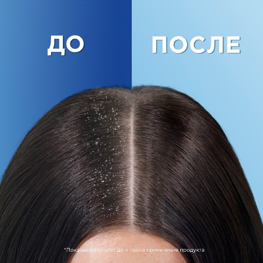 Шампунь HEAD&SHOULDERS Питательный уход 400 мл (4084500607781) - Фото 6